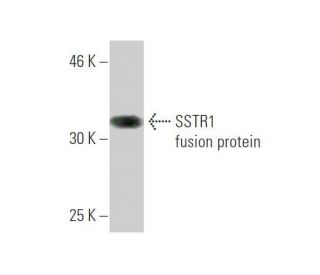 western blotting image from recommended SSTR1 (1F7) monoclonal antibody replacement. Image 348856