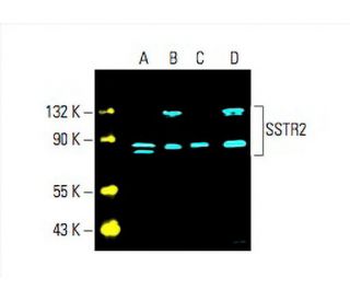 SSTR2 Antibody (A-8) - Western Blotting - Image 393679 