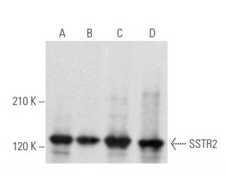western blotting image from recommended SSTR2 (A-8) monoclonal antibody replacement. Image 355567