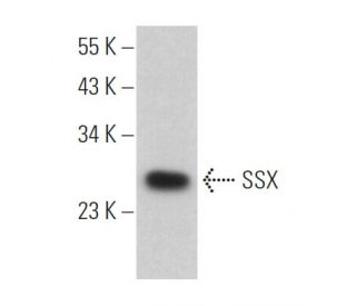 SSX Antibody (C-9) - Western Blotting - Image 365498