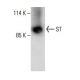 ST Antibody (H-8) - Western Blotting - Image 394295