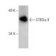 ST8Sia II Antibody (B-12) - Western Blotting - Image 286915 