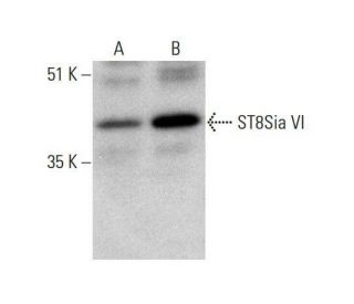 ST8Sia VI Antibody (E-3) - Western Blotting - Image 351854 
