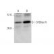 ST8Sia VI Antibody (E-3) - Western Blotting - Image 351854 