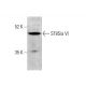 ST8Sia VI Antibody (E-3) - Western Blotting - Image 375611 