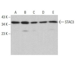STAC3 Antibody (E-2) - Western Blotting - Image 376725 
