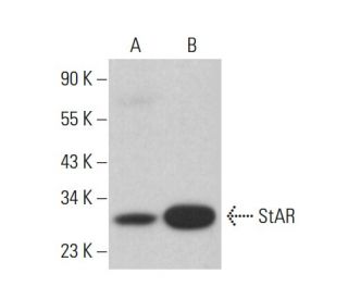 StAR Antibody (D-2) - Western Blotting - Image 385291 