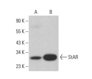western blotting image from recommended StAR (D-2) monoclonal antibody replacement. Image 385291