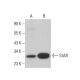 western blotting image from recommended StAR (D-2) monoclonal antibody replacement. Image 385291