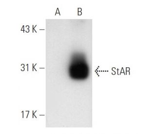 StAR (D-2): sc-166821. Western blot analysis of StAR expression in...