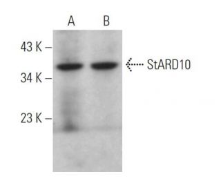 StARD10 Antibody (C-11) - Western Blotting - Image 370817 