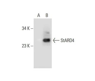 StARD4 Antibody (F-7) - Western Blotting - Image 289473SAM Transcription Activation: SAM system utilizing dCas9-VP64, MS2-P65-HSF1, and sgRNA for precise gene transcription activation. 