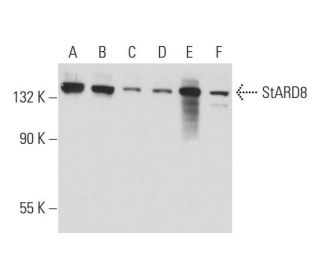 StARD8 Antibody (E-2) - Western Blotting - Image 128771 