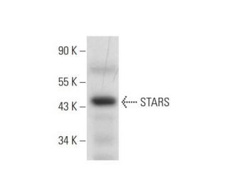 STARS Antibody (E-9) - Western Blotting - Image 291928Each CRISPR/Cas9 Knockout (KO) Plasmid product consists of a pool of 3 plasmids designed to ensure identification and cleavage of a specific gene for maximum knockout efficiency. Each plasmid encodes a unique 20 nt sequence derived from the GeCKO (v2) library.