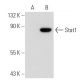 Stat1 Antibody (6D776) - Western Blotting - Image 43571 