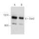 Stat2 Antibody (B-3) - Western Blotting - Image 353690