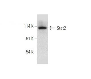 western blotting image from recommended Stat2 (B-3) monoclonal antibody replacement. Image 316297
