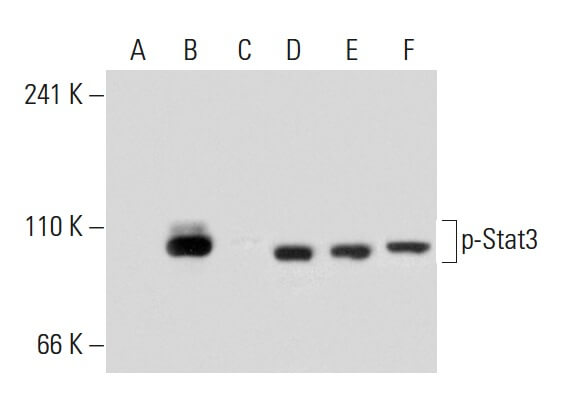 Anti-Stat3 Antibody (F-2) | SCBT - Santa Cruz Biotechnology