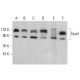 This polyclonal antibody has been discontinued. See our recommended <a href="stat4-antibody-c-4">Stat4 (C-4)</a> monoclonal antibody (sample data shown). western blotting image from recommended Stat4 (C-4) monoclonal antibody replacement. Image 378474
