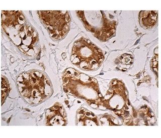 immunohistochemistry image from recommended Stat5a (C-6) monoclonal antibody replacement. Image 160248