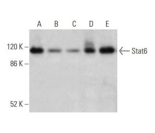 Stat6 Antibody (AS6-45.13.9) - Western Blotting - Image 353200
