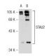 STAU2 Antibody (S-35) - Western Blotting - Image 125805