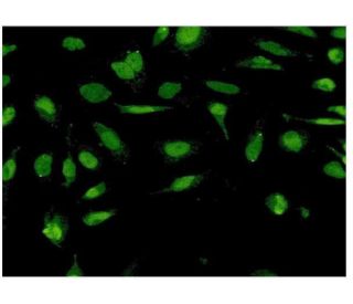 immunofluorescence image from recommended STC1 (1A3) monoclonal antibody replacement. Image 351752