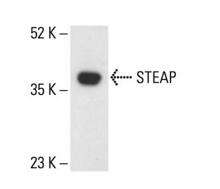 STEAP Antibody (B-4) - Western Blotting - Image 404789