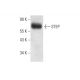 STEP Antibody (23E5) - Western Blotting - Image 11777