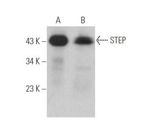 STEP Antibody (F-9) - Western Blotting - Image 375859 