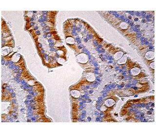 Stim1 Antibody (A-8) | SCBT - Santa Cruz Biotechnology