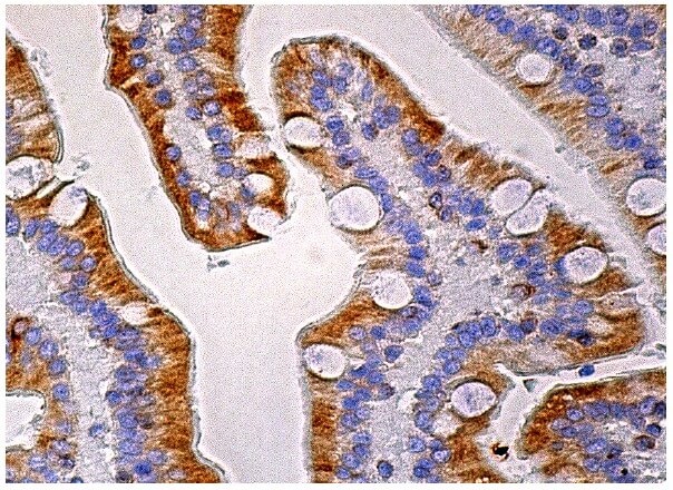 stim1-antibody-a-8-