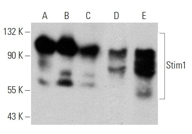 k.mさま専用 stim1-antibody-a-8-western-