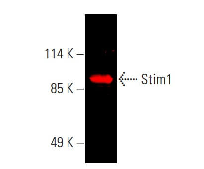 k.mさま専用 stim1-antibody-a-8-western-