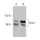 Stim1 Antibody (F-2) - Western Blotting - Image 359457 