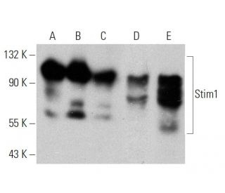 western blotting image from recommended Stim1 (A-8) monoclonal antibody replacement. Image 359932