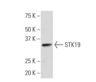 STK19 Antibody (3B6) - Western Blotting - Image 33800