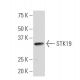 STK19 Antibody (3B6) - Western Blotting - Image 33800
