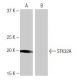 STK32A Antibody (5H10) - Western Blotting - Image 65064