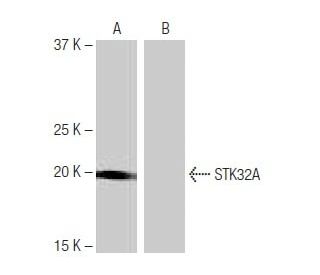 STK32A Antibody (5H10) - Western Blotting - Image 65064Each CRISPR/Cas9 Knockout (KO) Plasmid product consists of a pool of 3 plasmids designed to ensure identification and cleavage of a specific gene for maximum knockout efficiency. Each plasmid encodes a unique 20 nt sequence derived from the GeCKO (v2) library.