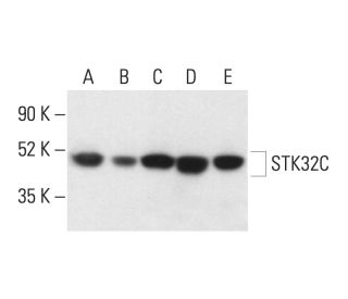 STK32C Antibody (C-6) - Western Blotting - Image 403832 