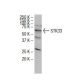 STK33 Antibody (YZ-16) - Western Blotting - Image 33811