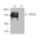 STKLD1 Antibody (6G9) - Western Blotting - Image 64879