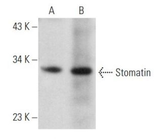 western blotting image from recommended Stomatin (E-5) monoclonal antibody replacement. Image 357199
