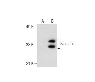 Stomatin Antibody (E-6) - Western Blotting - Image 160547