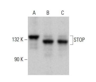 STOP Antibody (175) - Western Blotting - Image 379175 