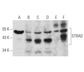 STRAD Antibody (G-8) - Western Blotting - Image 354255 