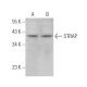 STRAP Antibody (E-8) - Western Blotting - Image 371893 