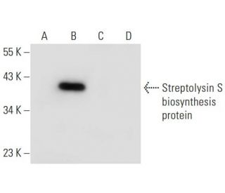 Streptolysin S biosynthesis protein Antibody (C-10) - Western Blotting - Image 304944