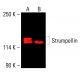 Strumpellin Antibody (B-10) - Western Blotting - Image 416253 